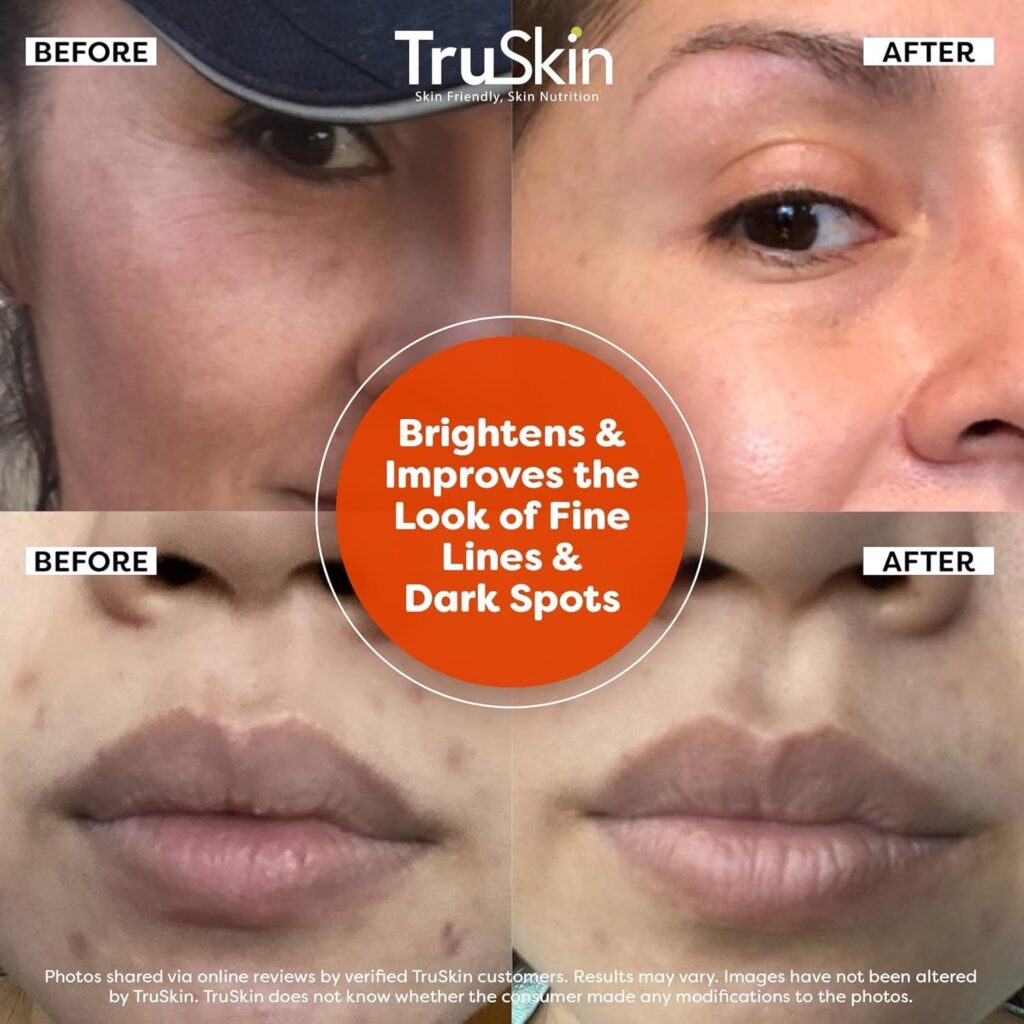 �� Product Comparison: TruSkin Vitamin C Serum vs CeraVe Hyaluronic Acid Serum.